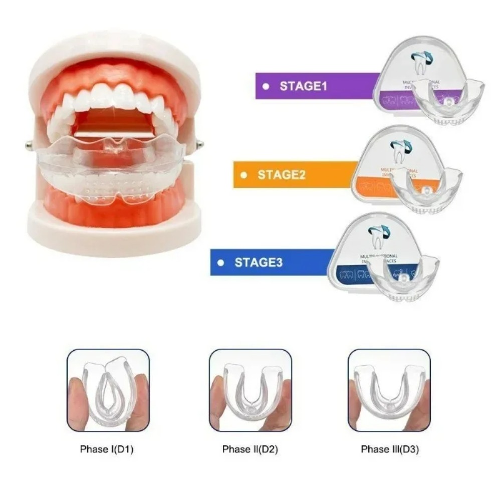 Teeth Whitening For Braces - Orthodontic Brace Straightener Dental Braces Teeth