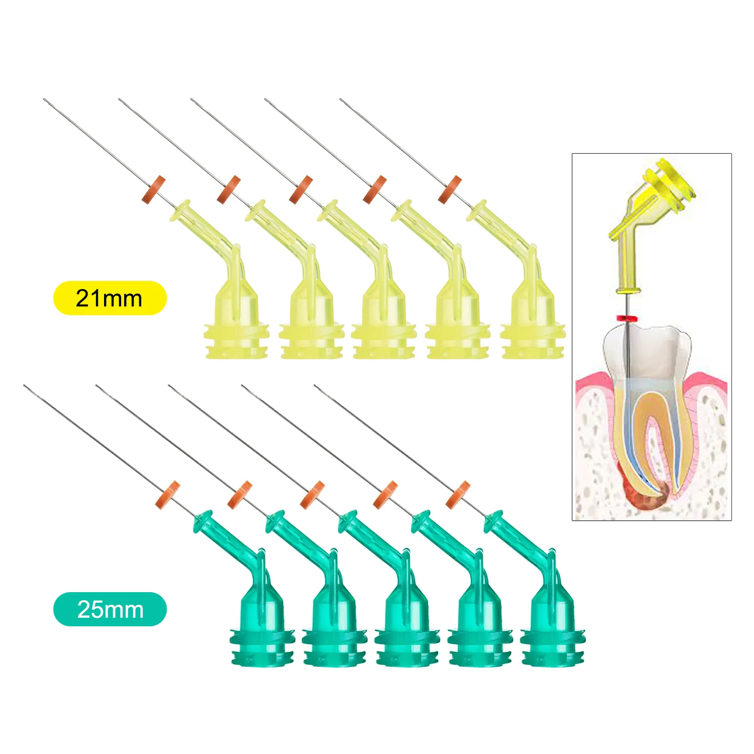10pcs JOLANT Dental Irrigation - Teeth Whitening Tips ulasan dan harga