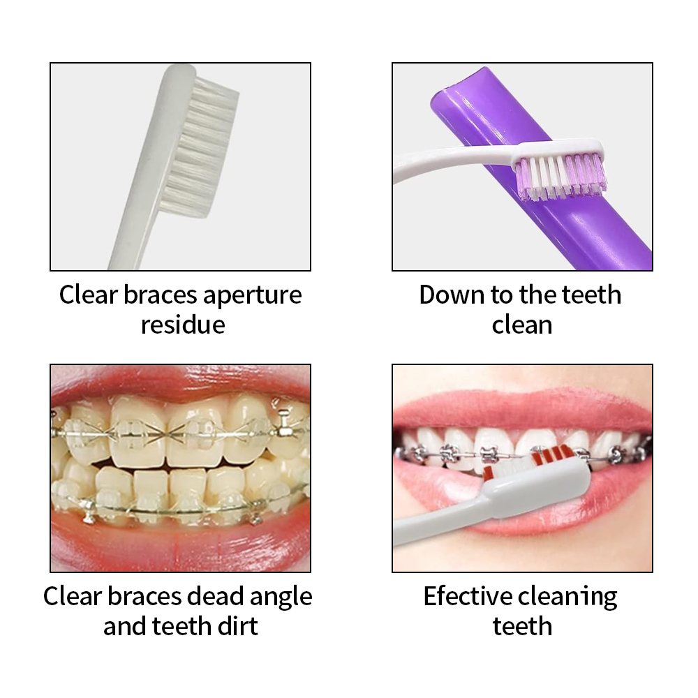 8Pcs/set Orthodontic Dental Ca - Teeth Whitening For Braces ulasan dan harga