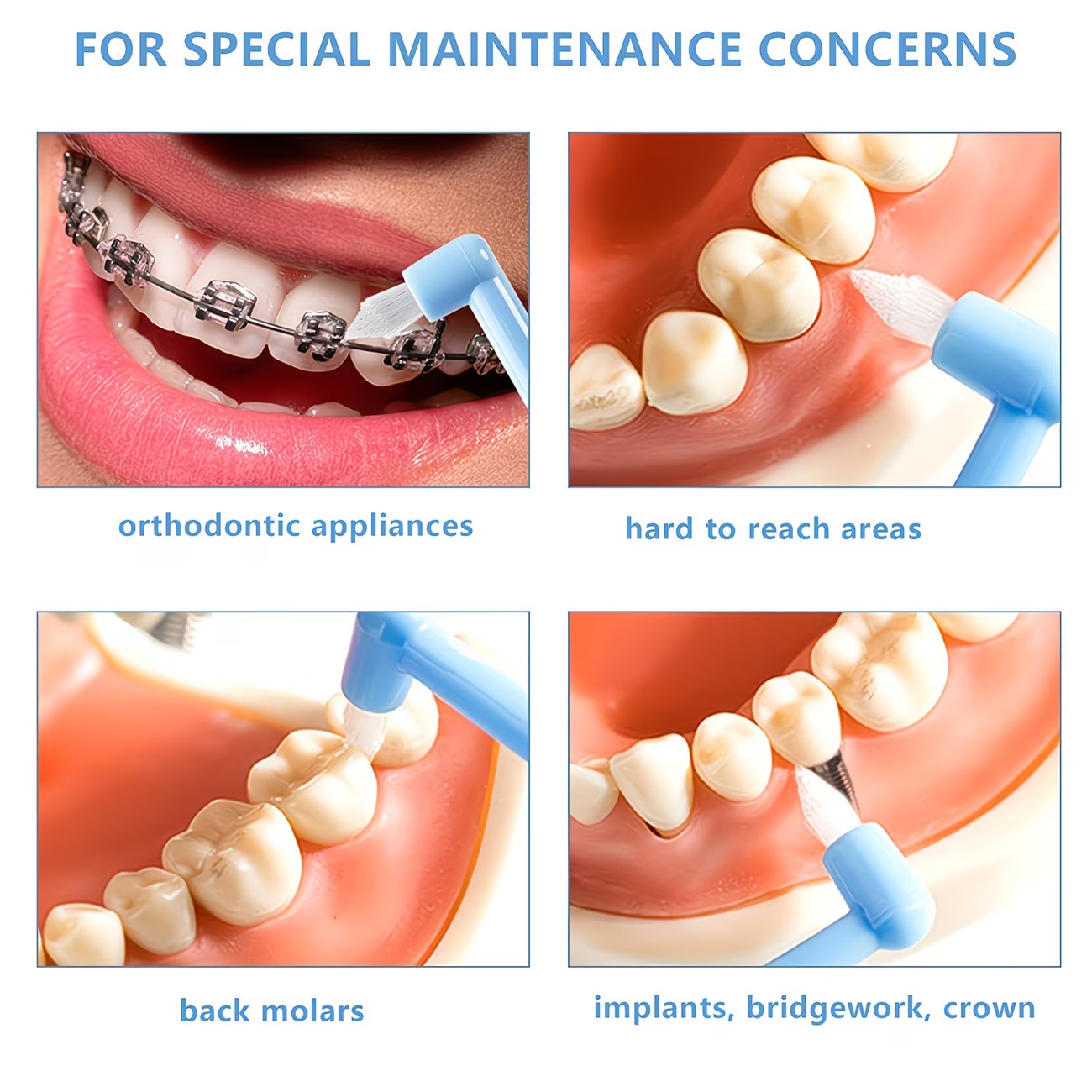 1/3pc Orthodontic Braces Tooth - Teeth Whitening For Braces ulasan dan harga