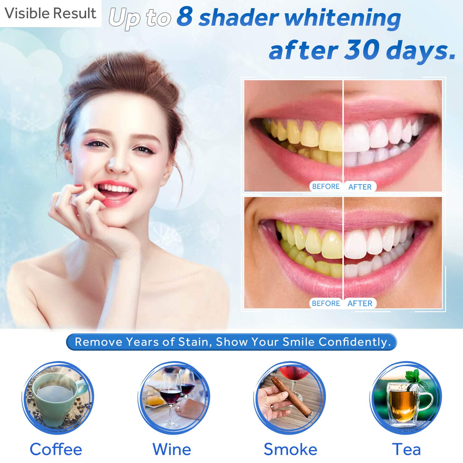 Teeth Whitening Gel Refill Syr - Teeth Whitening Procedure ulasan dan harga