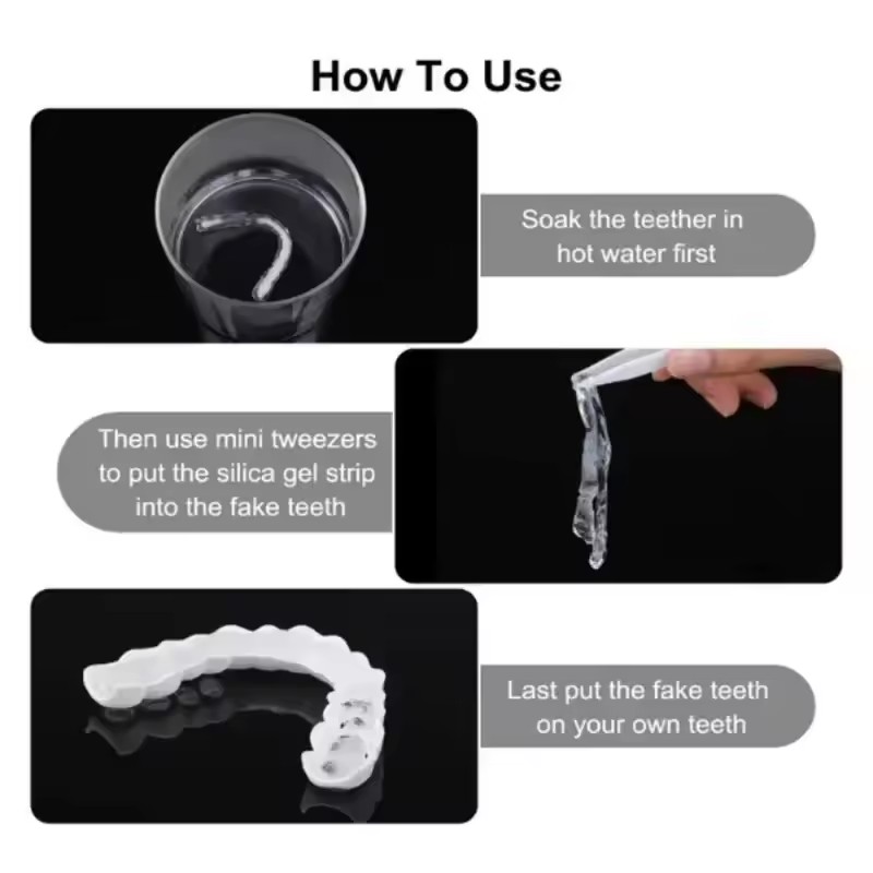 Teeth Veneers Whitening Dentur - Teeth Whitening For Braces ulasan dan harga