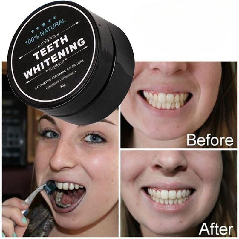 1 Box Activated Charcoal Teeth - Teeth Whitening Co ulasan dan harga