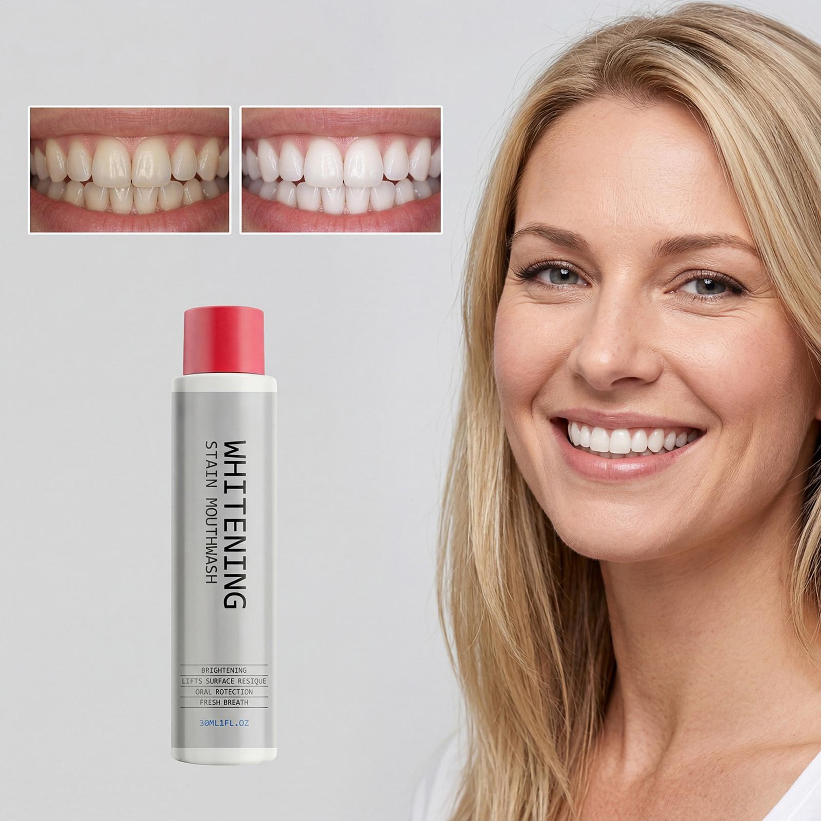 30ml Stain Whitening Mouthwash - Teeth Whitening And Stain Removal ulasan dan harga