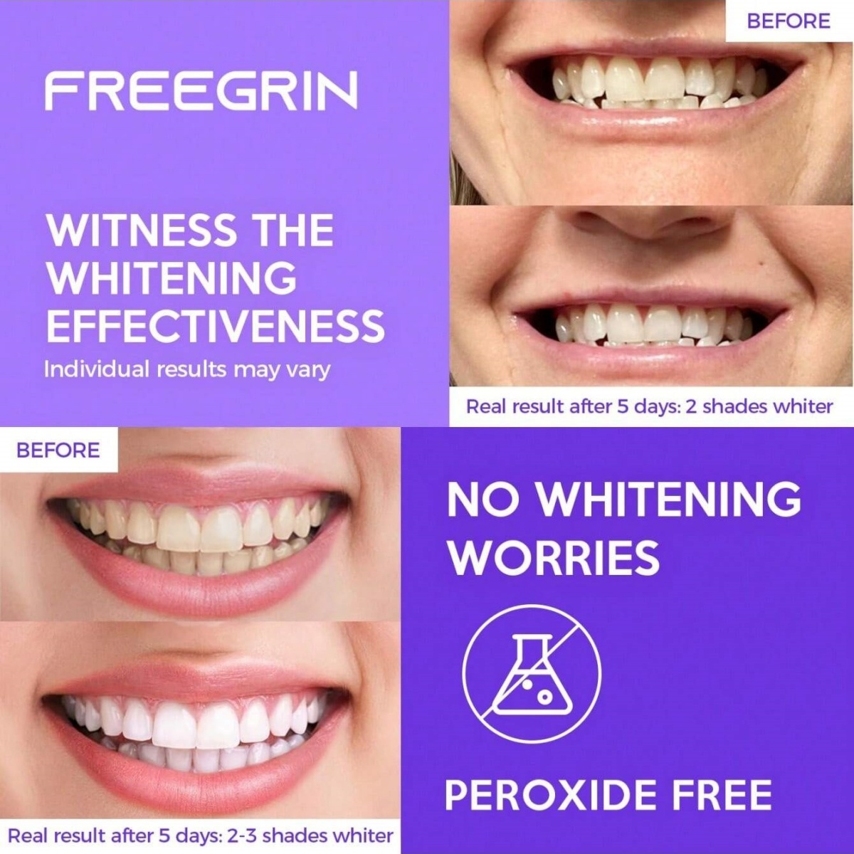 Deluxe Whitening Teeth Sticker - Teeth Whitening Ai ulasan dan harga