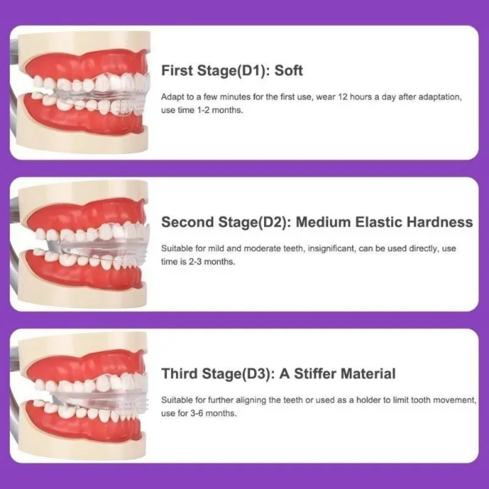 Orthodontic Brace Straightener - Teeth Whitening For Braces ulasan dan harga
