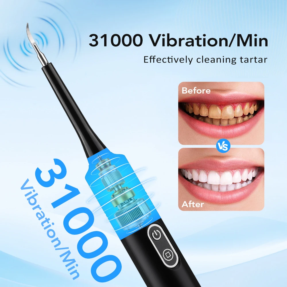 Electric Sonic Vibration Denta - Teeth Whitening And Stain Removal ulasan dan harga